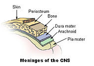 Meningitis