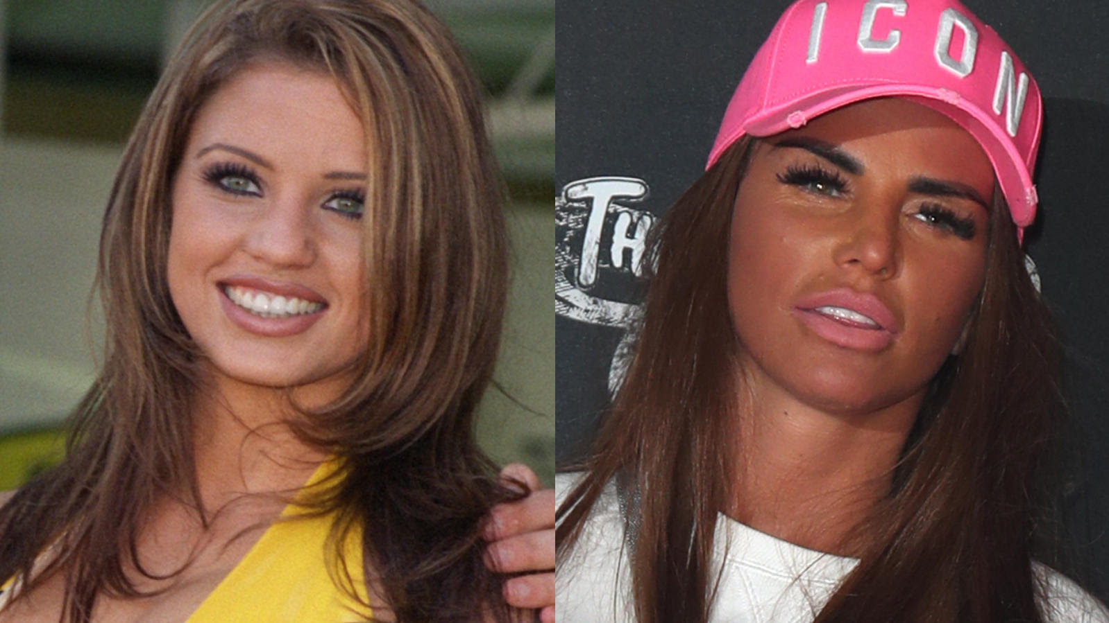 Katie Price So Krass Hat Sie Sich Nach Ihren Vielen Beauty Ops Verandert