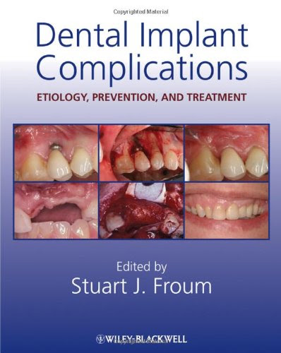 Remarkable Dental Implants 398 x 500 · 39 kB · jpeg