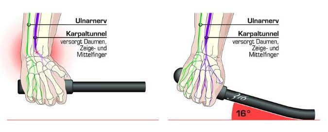 Taube Finger Fahrrad Gesundheit