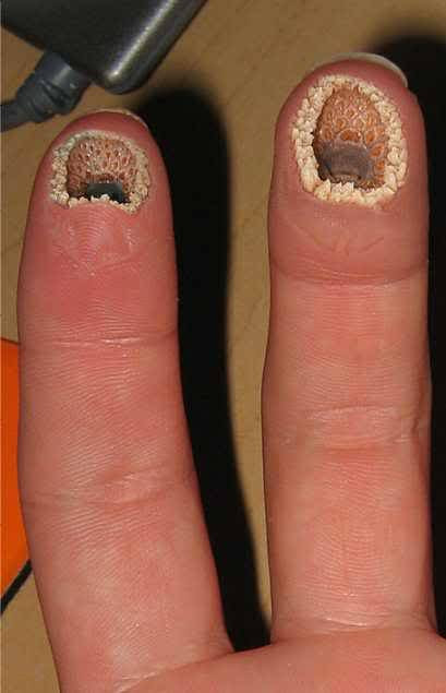 Images: Trypophobia