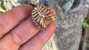 Rib Cage : Left rib cage pain | Musculoskeletal Issues articles | Body & Health Conditions center ...