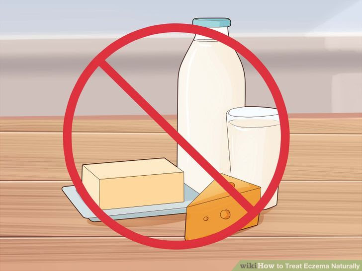 Treat Eczema Naturally Step 16 Version 2.jpg