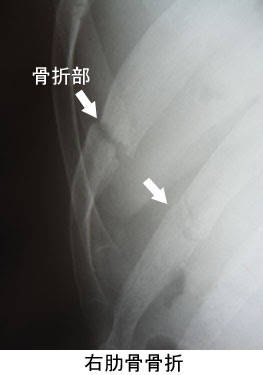 痛みの話q A 八王子整形外科 西八王子駅近くの整形外科専門クリニック