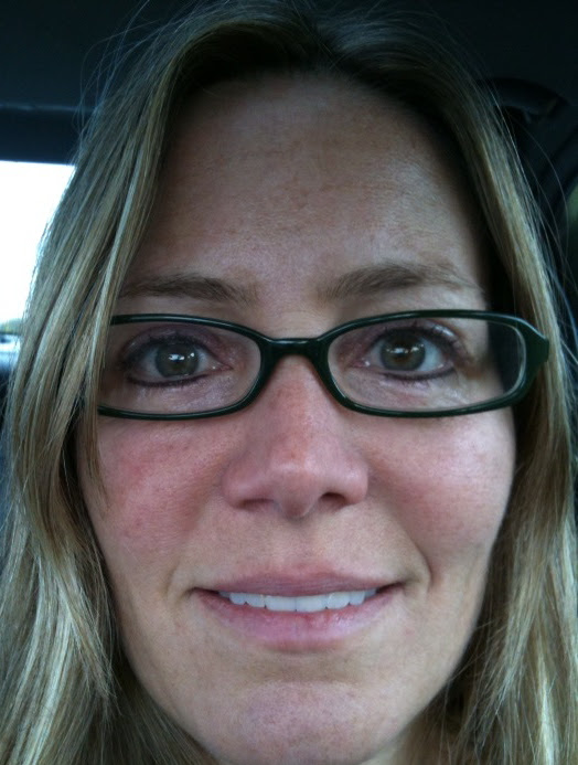 Day 3-4: Cosmetic Tattoo Eyeliner, Soothing, Healing