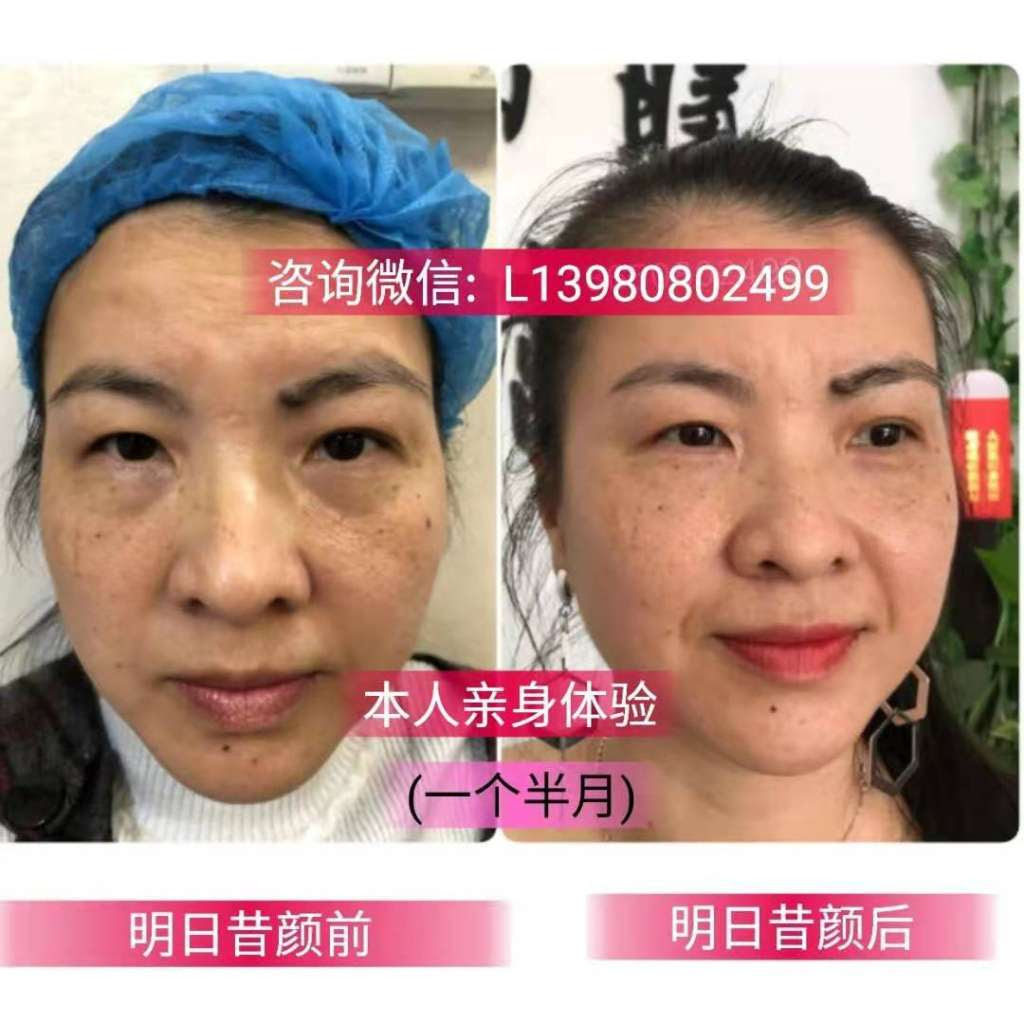 明日昔颜美容院加盟条件有哪些 需要投资多少钱 靠谱吗 未来养生网