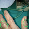 Skin Cancer Types Scc / Wart-Like Pink Lump on Dog's Leg / © 2021 mjh life sciences™ and pharmacy times.