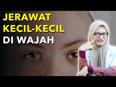 TUMBUH JERAWAT KECIL KECIL DI WAJAH INI PENYEBABNYA DAN CARA MENGHILANGKANNYA