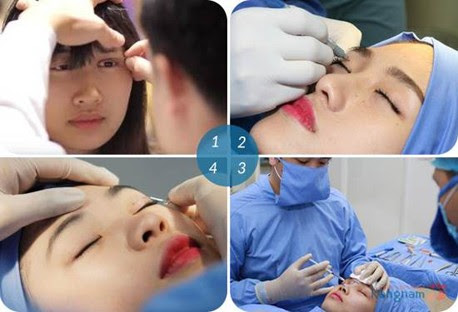 thẩm mỹ mắt to ở đâu đẹp nhất 8