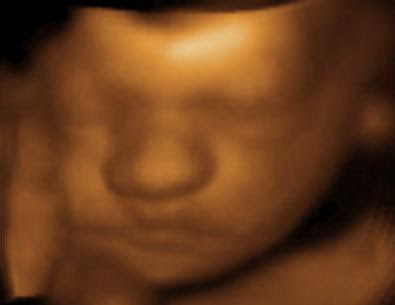3d ultrasound pictures at 20 weeks. girlfriend images 3d ultrasound 20 weeks 3d ultrasound 20 weeks pregnant.