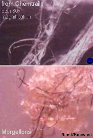 ТРЕТЬЯ МИРОВАЯ ВОЙНА УЖЕ НАЧАЛАСЬ. О тайнах новых технологий смерти