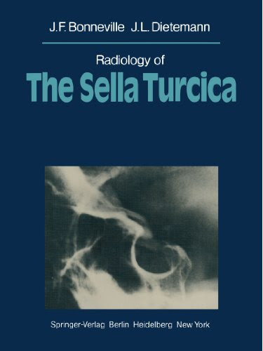 Radiology of The Sella TurcicaBy J. F. Bonneville, J. L. Dietemann