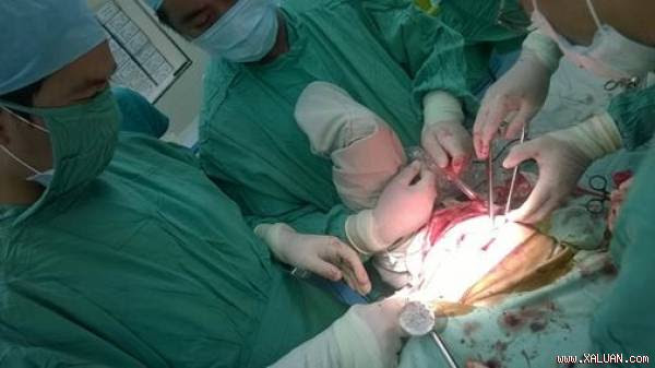 Bệnh nhân tử vong sau phẫu thuật thay chỏm xương đùi