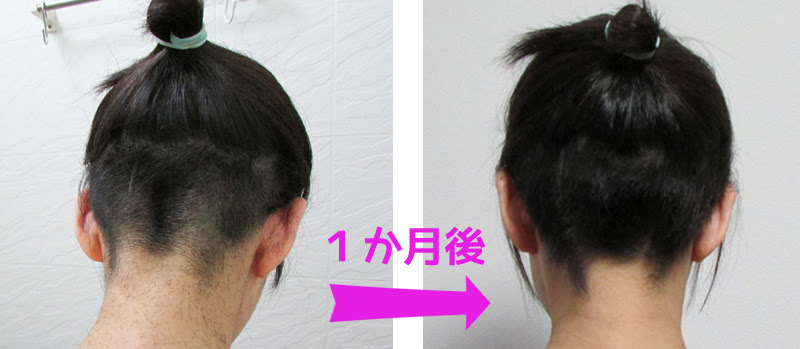 ツーブロック女子 伸びかけの刈り上げ １カ月目はこんな感じ みなこのブログ