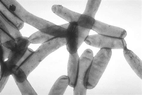 La legionella è un bacillo che provoca una malattia che si trasmette per via aerea chiamata legionellosi che colpisce prevalentemente il sistema . Legionellen in Alters- und Pflegeheimen: Ein potentielles