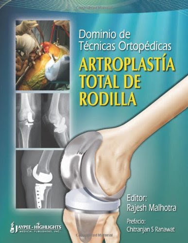 Dominio de Tecnicas Ortopedicas: Artroplastia Total de Rodilla (Spanish Edition), by Rajesh Malhotra