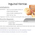 Silk Sign In Hernia - This is referred to as the “silk glove sign” and is evidence of swelling .