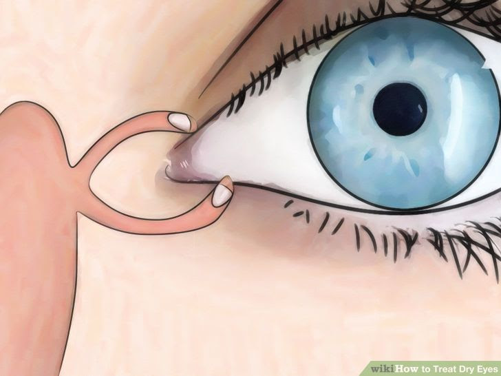 Treat Dry Eyes Step 6.jpg
