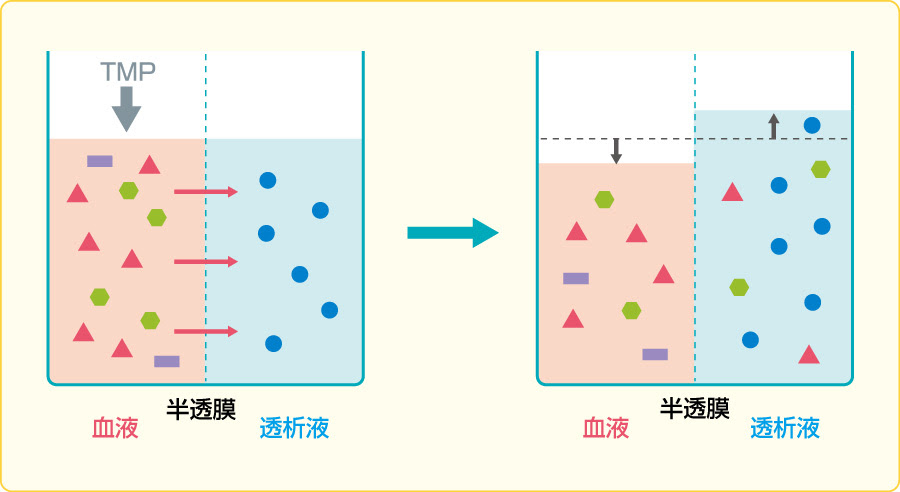 膵臓 摘出