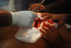 Habib Nasser Sword Matam Wound by firoze shakir photographerno1