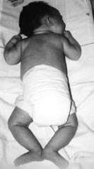 Accueil Un Service De Reanimation Et De Neonatalogie La Prematurite Presentation Generale De La Psychomotricite La Psychomotricite En Neonatalogie Les Mediations Psychomotrices Le Suivi Des Prematures En Consultation Le Bilan Psychomoteur Les Soins