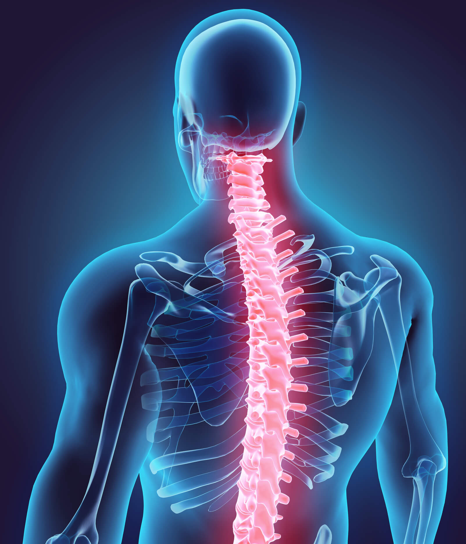 Middle And Upper Thoracic Back Pain