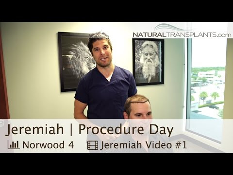 View 27 Natural Transplants Hair Restoration Clinic