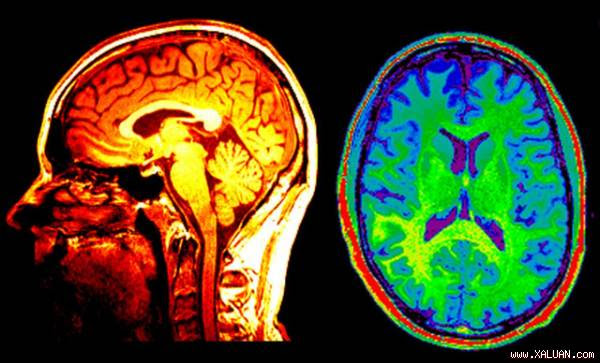 Thuật toán có khả năng nhận diện người đang muốn tự tử