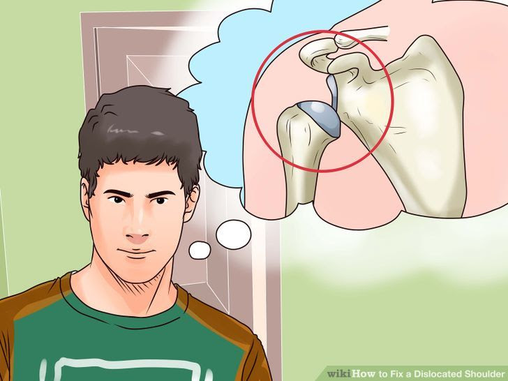 Fix a Dislocated Shoulder Step 1 Version 3.jpg