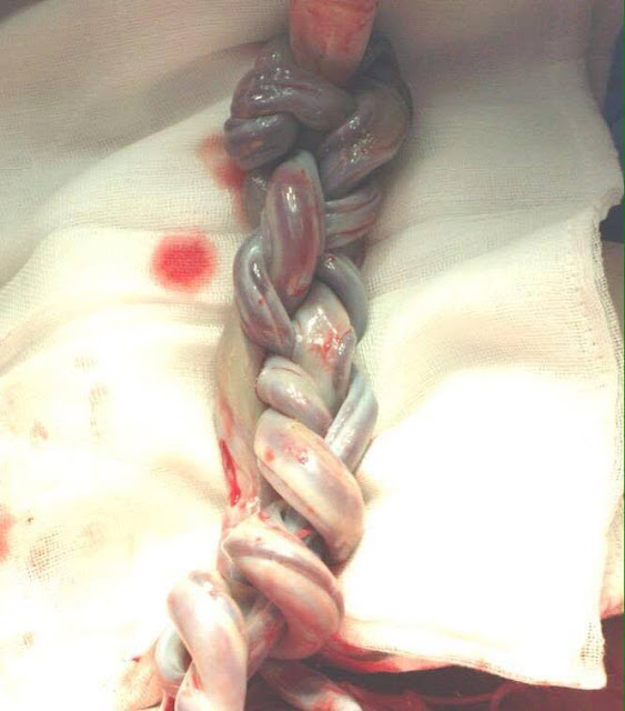 The Doctor Told Her To Keep Her Pregnancy A Secret Because The Baby Could Possibly Die. But The Next Thing That Happened Was Unexpected!