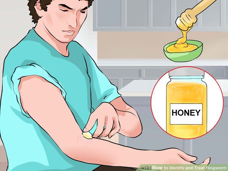 Identify and Treat Ringworm Step 8 Version 2.jpg