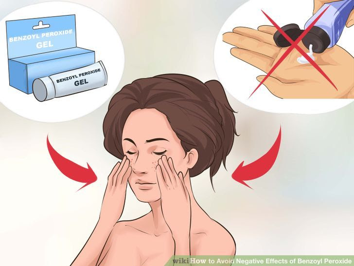 Avoid Negative Effects of Benzoyl Peroxide Step 5 Version 2.jpg