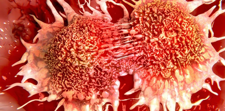 Prostate Cancer Diagnosis Require Treatment / Prostate biopsy ultrasound equipment - Stock Image C001 / If breast cancer is diagnosed at an early enough stage, it’s treatable.