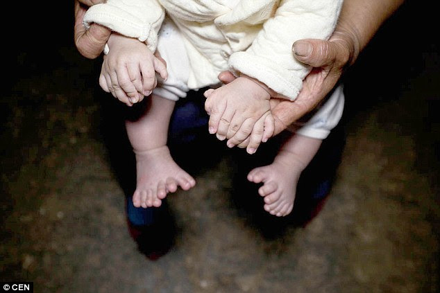 Reality: Both of Honghong's feet have eight toes while one of his hands has eight fingers and the other, seven