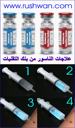 صورة
