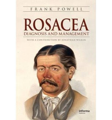 [(Rosacea: Diagnosis and Management)] [Author: Frank Powell] published on (December, 2008), by Frank Powell