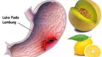 Gabung Dua Buah Ini Maag Vertigo Asam Urat dan Gabung Dua Buah Ini Maag Vertigo Asam Urat dan
