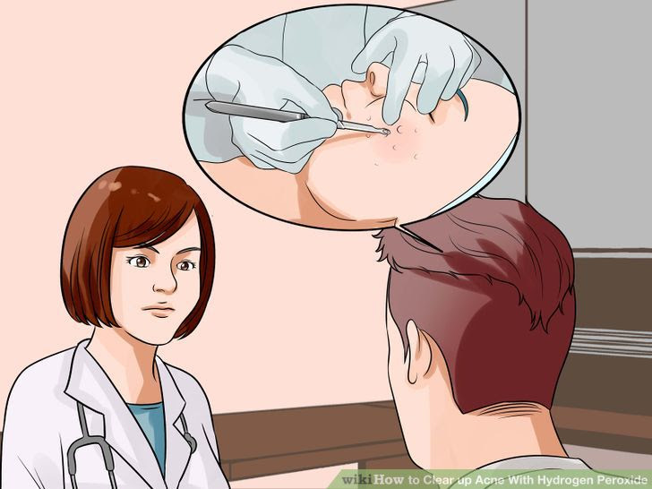 Clear up Acne With Hydrogen Peroxide Step 11.jpg