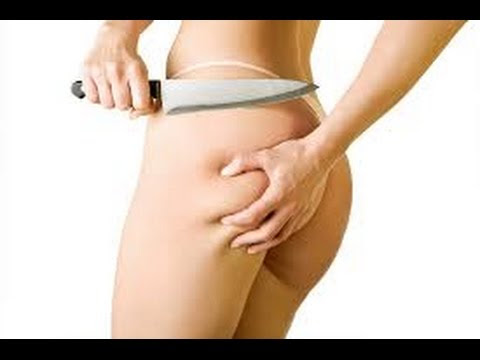 ... Cellulite on Thighs and Bum Naturally at Home – Cellulite Treatment