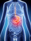 Mesothelioma Cancer In Stomach - Psoriasis or skin cancer? How to tell the difference