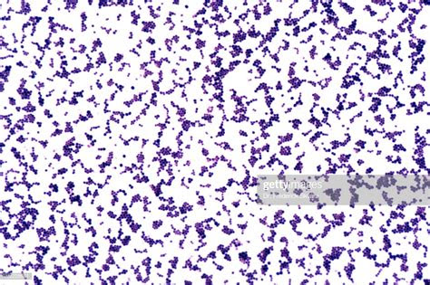 bacteria staphylococcus aureus  grampositive coccus gram