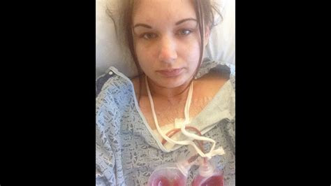 day  mastectomy days    youtube