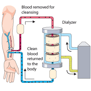 dialysis device specs