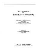 The Technique of Total Knee Arthroplasty, by Kenneth A. Krackow
