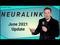 Ο Elon Musk παρουσιάζει το τσιπ Neuralink που εμφυτεύεται στον εγκέφαλο