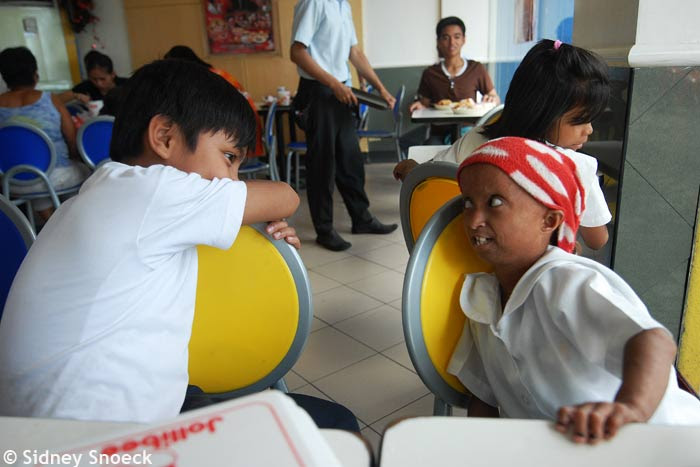 Rochelle progeria premature aging PhilippinesDSC_0545