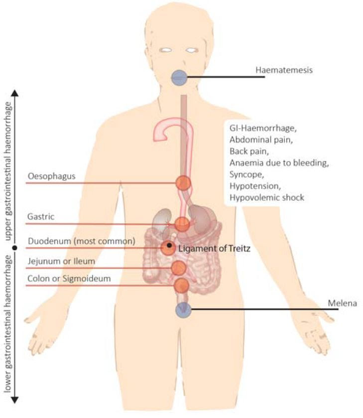 Thorakales Aortenaneurysma Wpgefaessmanual2016
