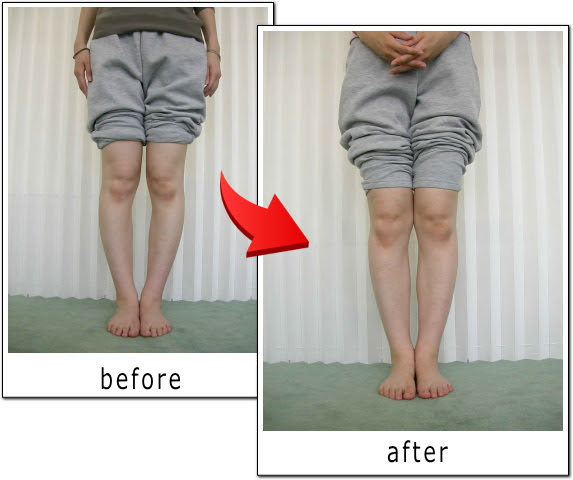 プロが習いに来るo脚矯正技術 東京