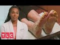 コンプリート！ my feet 181195-My feet are killing me episodes