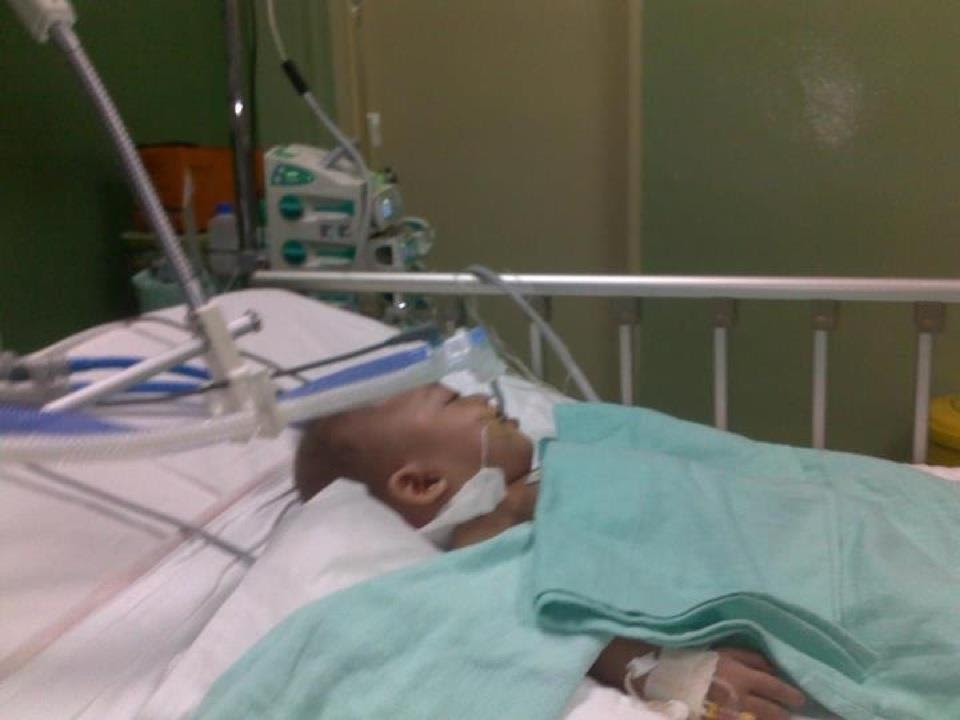 Jangkitan Respiratory Syncytial Virus (RSV)  Dr Zubaidi 